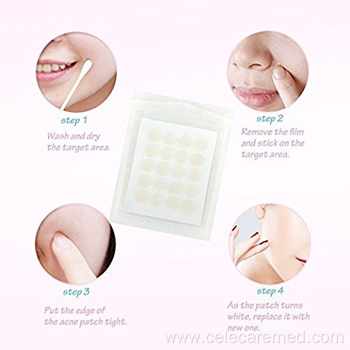 Natural Acne Patch Sticker Hydrocolloid Absorbing Acne Patch